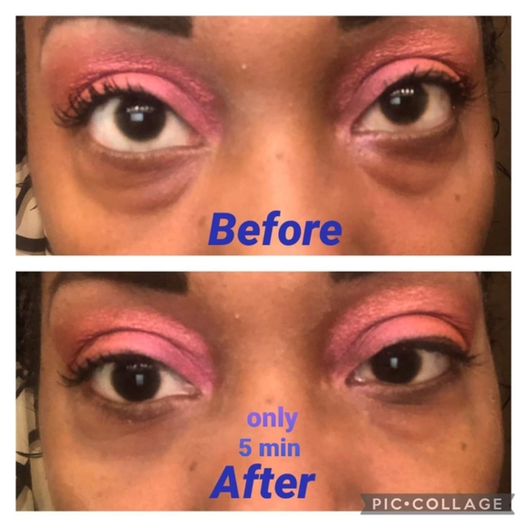 NEW! Rapid Rewind Wrinkle Reducer - Picture 6 of 16